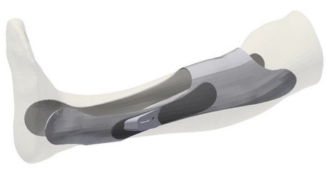 個(gè)性化加固設(shè)計(jì)的軟件工具，個(gè)性化加固設(shè)計(jì)的軟件工具 行業(yè)新聞 第3張